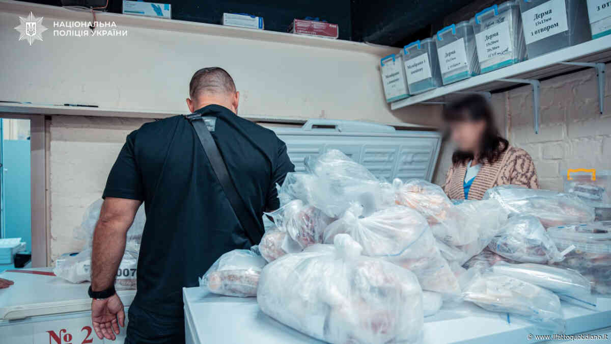 “Ai famigliari dici che sono per i militari e quelli accettano l’espianto”: medici indagati per traffico d’organi in Ucraina