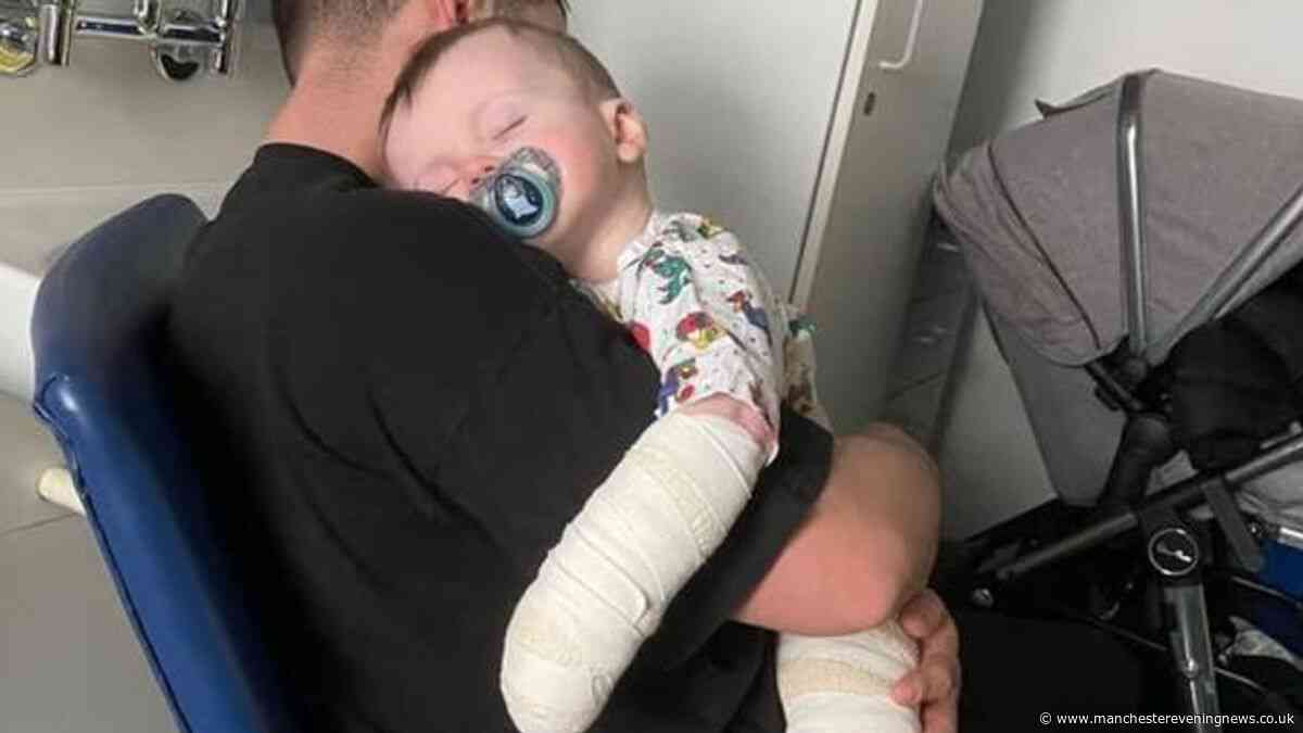 Toddler left with second-degree bleach burns as nursery admits safety breach
