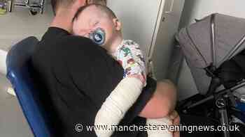 Toddler left with second-degree bleach burns as nursery admits safety breach