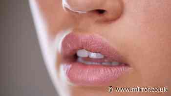 Lesser-known mouth symptoms could mean you have iron deficiency anaemia