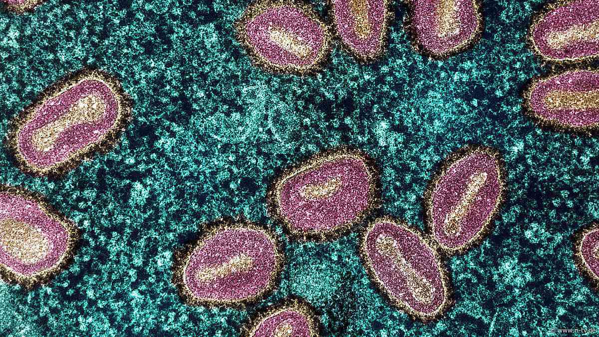 Übertragung von Mensch zu Mensch: Studie: Spermien können Mpox-Infektionen begünstigen