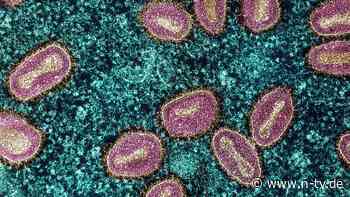 Übertragung von Mensch zu Mensch: Studie: Spermien können Mpox-Infektionen begünstigen