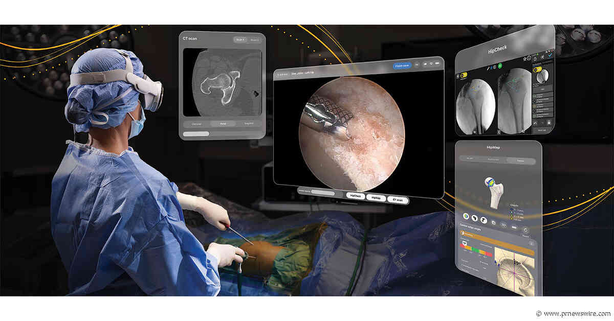 Stryker introduces first of its kind FDA-authorized surgical application for Apple Vision Pro with hip arthroscopy case at nationally recognized academic medical center