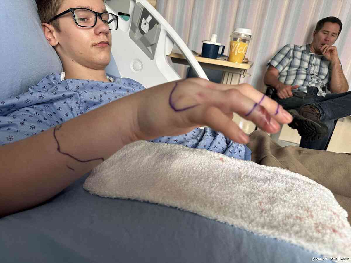 B.C. boy bitten by rattlesnake his father picked up: 'We made a few mistakes'