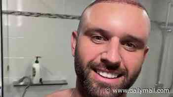 Married at First Sight groom Scott McCristal shares warning about hair transplant aftercare after treating his balding head
