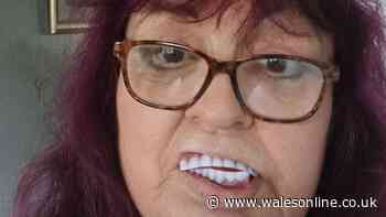 Neath gran says new teeth bought on Facebook 'look like Haribo sweets'