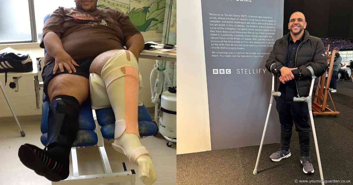 ‘I was shot three times and told I’d never walk again - now I’m starring on BBC Two’
