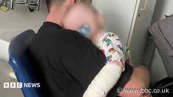 Nursery fined after baby boy burned by bleach