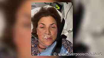 Kirstie Allsopp rushed to hospital in air ambulance after scary fall