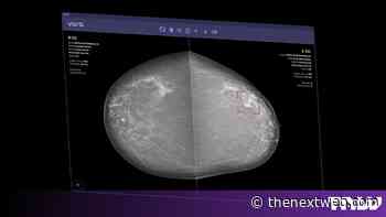Vara wins world’s first CE mark for AI that clears mammograms alone