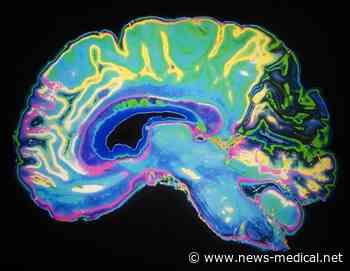 Brain-protecting immune cells may actually drive Alzheimer's disease