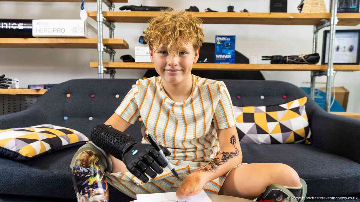 Boy, 11, fitted with 'amazing' bionic arm after losing four limbs to meningitis aged two