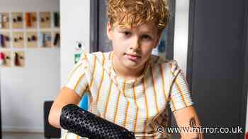 Boy, 11, who lost four limbs gets incredible bionic arm in time for secondary school