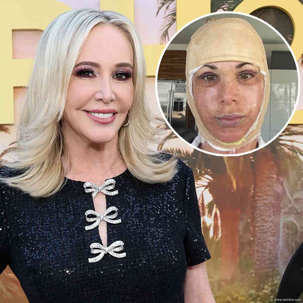 RHOC's Shannon Beador Shades Alexis Bellino's Facelift Reveal