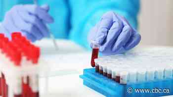 Shared Health to expand hours, increase capacity at some labs as Dynacare strike looms