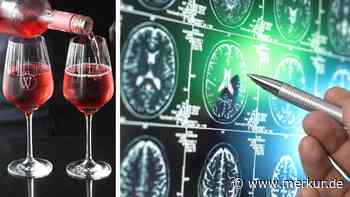 Alzheimer-Forschung mit überraschendem Befund: Strukturelle Veränderungen beginnen deutlich früher
