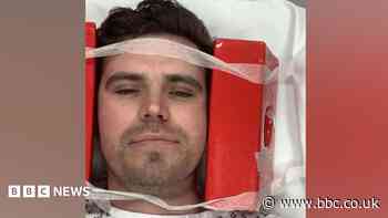 Man discovers broken neck in ski accident after sneezing
