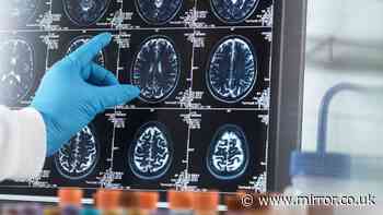 Alzheimer’s drug to be offered to people without symptoms to stop it developing