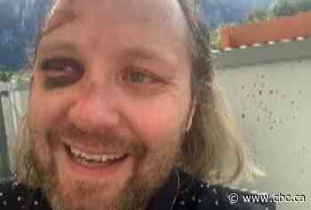 B.C. man lost for 5 nights in mountains near Squamish shares survival story