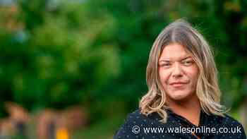 'My ex was a serial abuser and bit me on the ear. I fear he will kill'