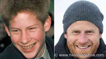 Queen Elizabeth II to Prince Harry: British royal teeth transformations seen in drastic before-and-after pictures