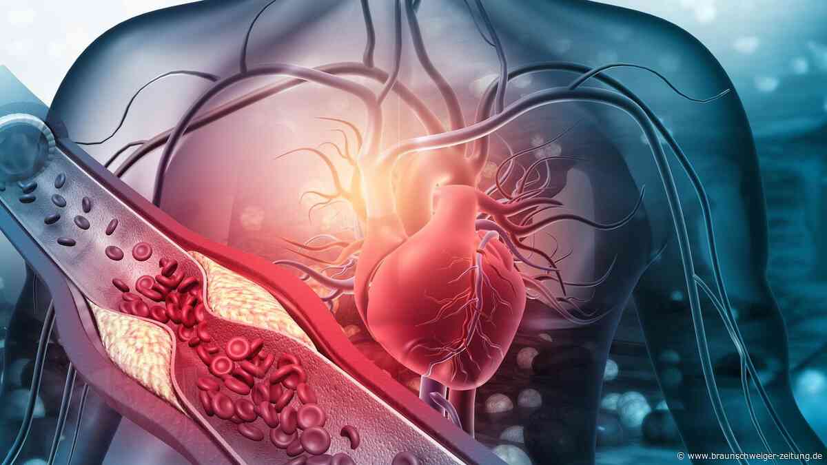 Arterien: Schon junge Erwachsene zeigen „bedrohliche“ Gesundheitswerte