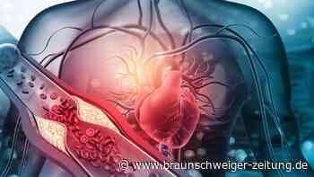 Arterien: Schon junge Erwachsene zeigen „bedrohliche“ Gesundheitswerte
