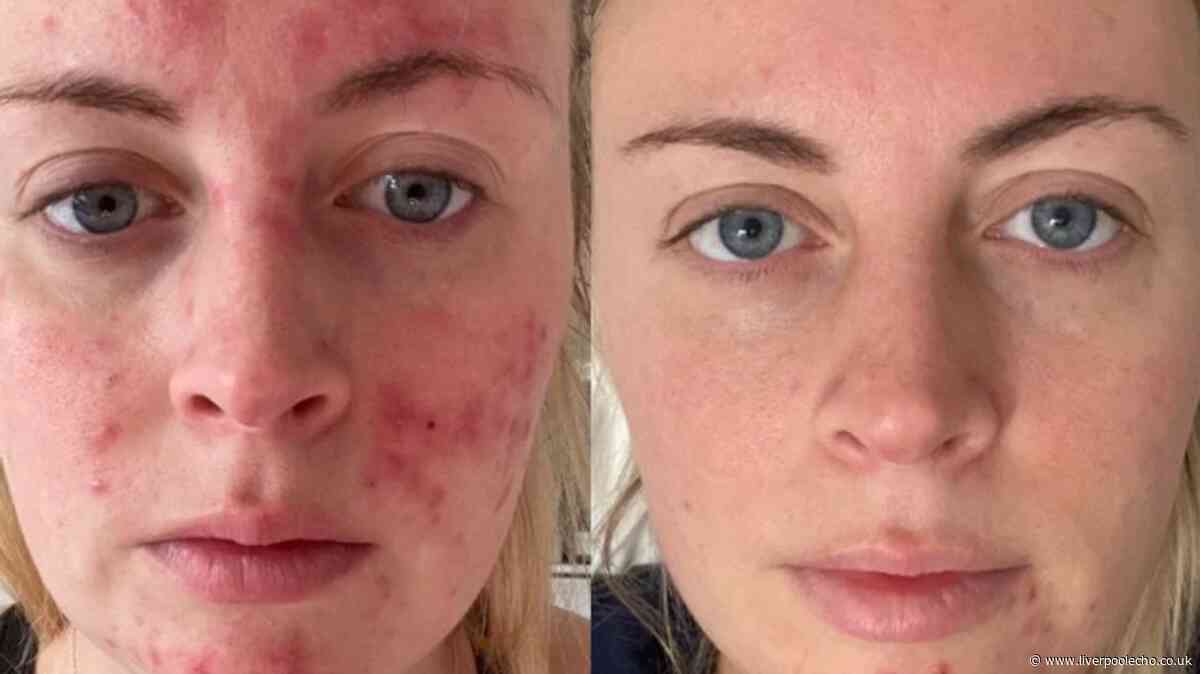'I feel confident walking around without makeup' with £29 serum: 'Thank you!'