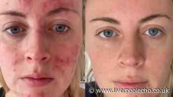 'I feel confident walking around without makeup' with £29 serum: 'Thank you!'