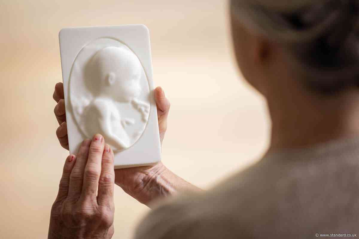 New pilot to turn ultrasounds into 3D-printed moulds for parents with sight loss
