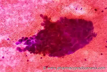 Sunvozertinib Tops Platinum Doublet in First-Line EGFR Exon 20 NSCLC