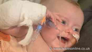 Baby's heart swelled to cover her chest 'survival chances were slim'