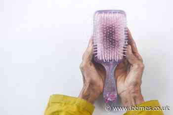 An Arthritis Drug Could Be an Unexpected Breakthrough for People With Severe Hair Loss