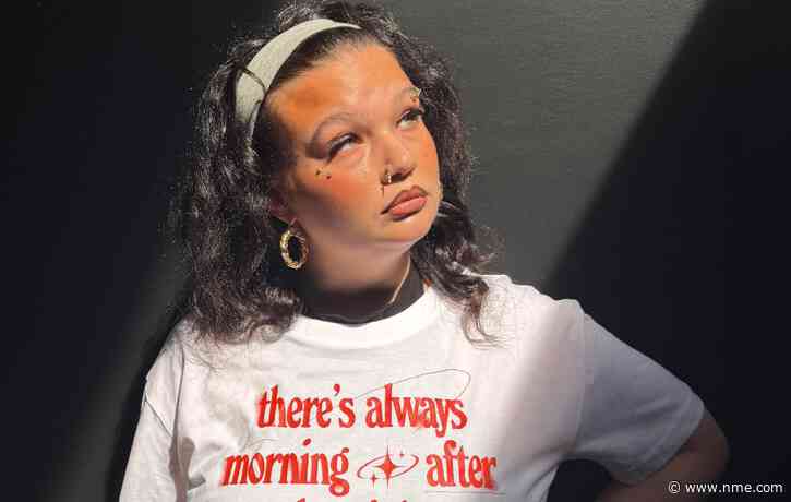 Lola Young teams up with mental health charity CALM for new Lifelines T-shirt: “There is always a reason to keep going”