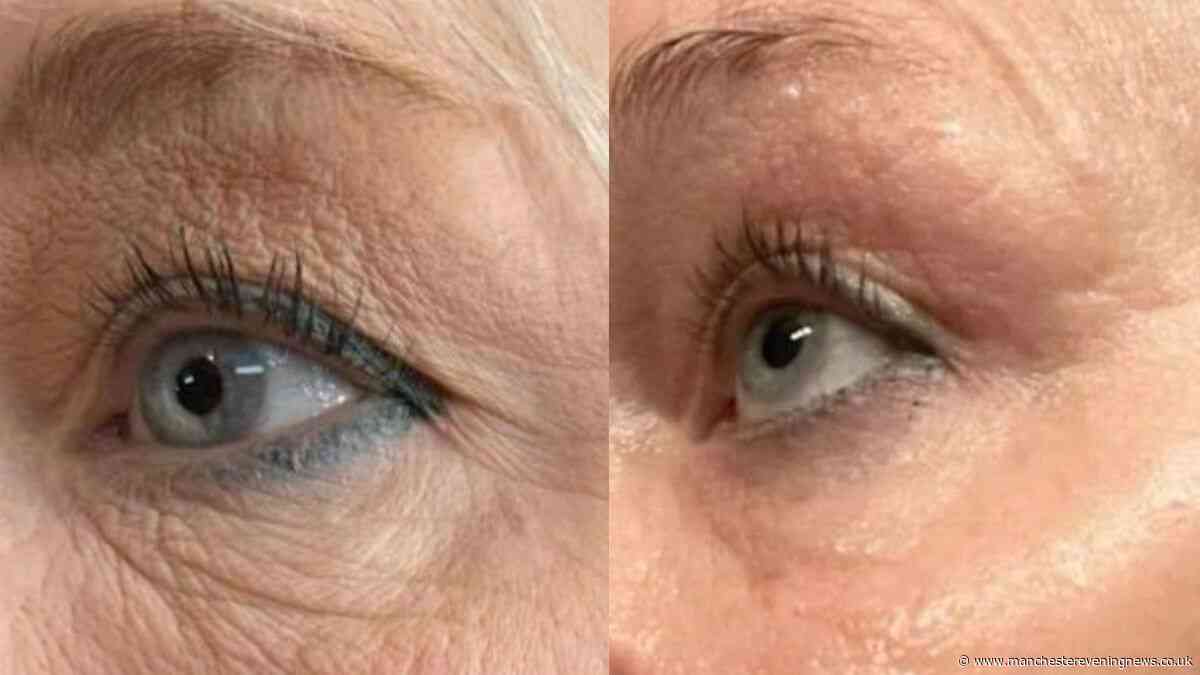 The 'line erasing' gadget claimed to work 'so well', 'my wife won't take it off'