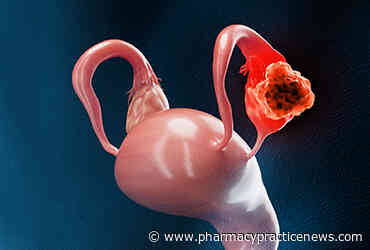Relacorilant Plus Nab-Paclitaxel Approved for Platinum-Resistant Ovarian Cancer