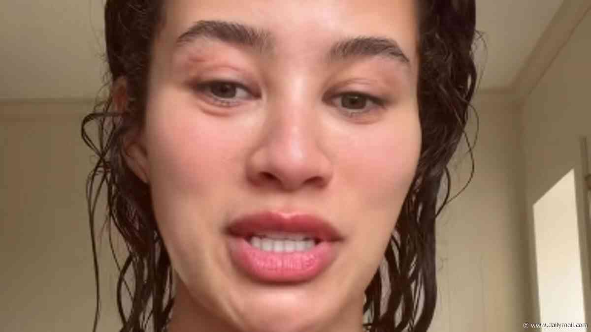 'This has upset me so much': Montana Brown reveals she has been diagnosed with female pattern hair loss and says 'balding' has 'knocked' her confidence