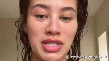 'This has upset me so much': Montana Brown reveals she has been diagnosed with female pattern hair loss and says 'balding' has 'knocked' her confidence