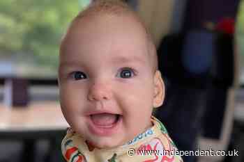 Baby given world-first treatment involving ‘super-elastic springs’ to reshape skull
