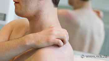 Übertragung in der Sauna: Seltene Hautkrankheit breitet sich aus – auch in NRW?
