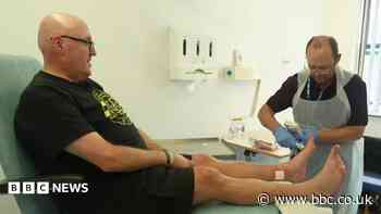 Diabetes-related amputations down as cases rising