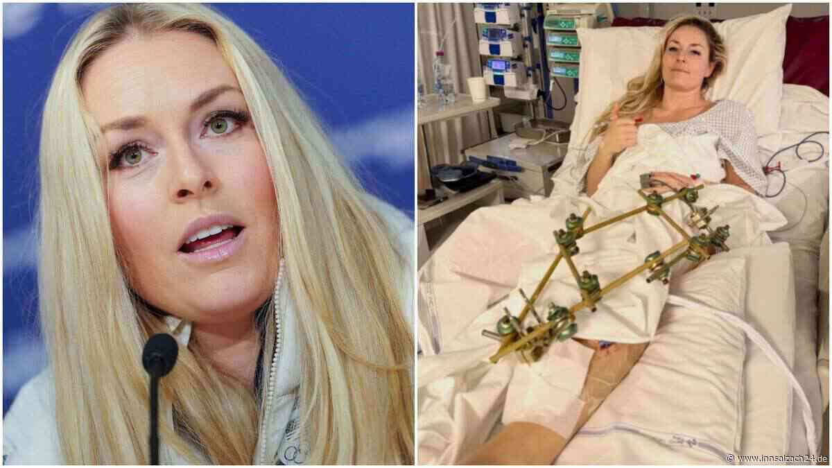 Nach Horror-Sturz bei Olympia: Ski-Superstar verkündet nächste Hiobsbotschaft