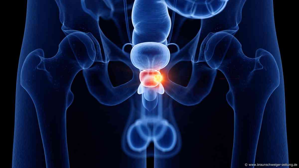 Prostatakrebs: Diese acht Muster verraten, welcher Tumor tötet