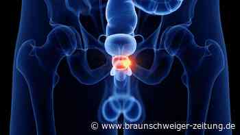 Prostatakrebs: Diese acht Muster verraten, welcher Tumor tötet