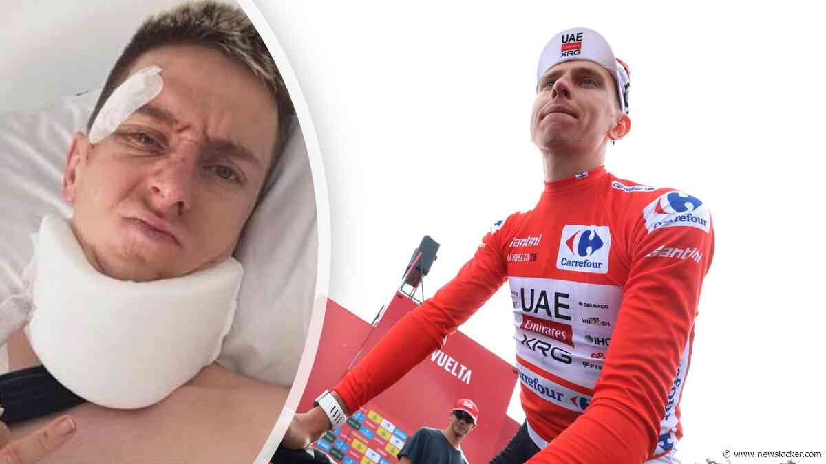 UAE-ploeggenoot geeft update over Tadej Pogacar na zware val: ’Met zijn blauw oog lijkt hij wat op een bokser, maar mentaal gaat het goed’