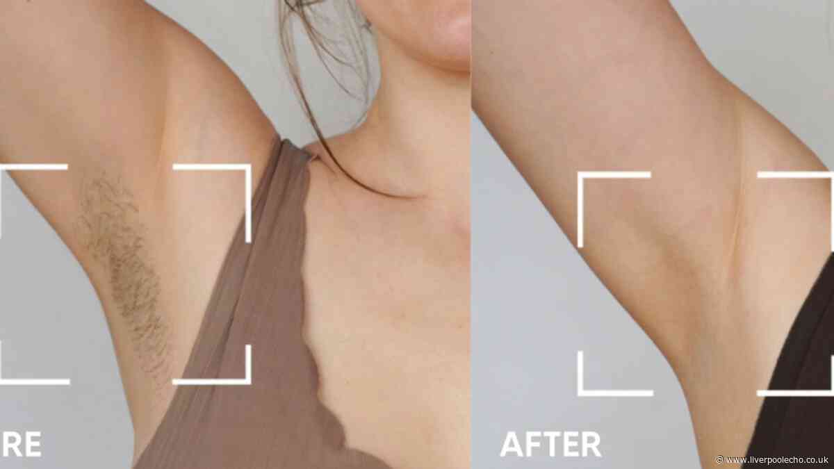 'Best hair removal method I've tried and less painful than waxing' now £170 off