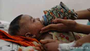 Bangladesh in grips of world's worst measles outbreak, with 1,000 dead in last 6 months