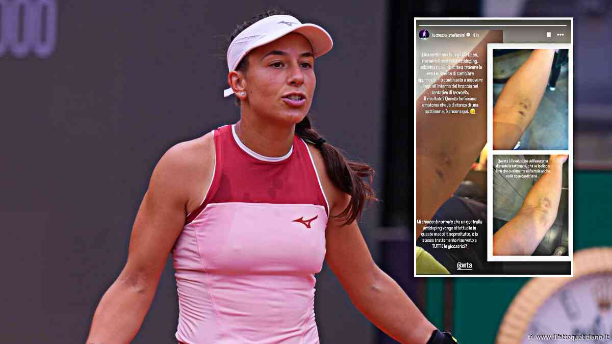 Us Open, Stefanini mostra un livido sul braccio: “Colpa di un controllo antidoping, non trovavano la vena e muovevano l’ago. Stesso trattamento per tutte?”