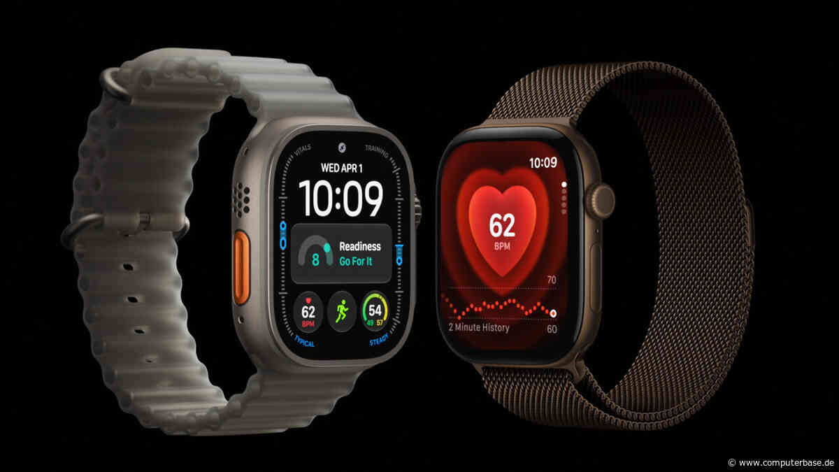 Apple Watch 12 und Ultra 4: Neue Gesund­heits­sensoren erfassen bis zu 60x mehr