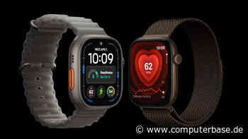 Apple Watch 12 und Ultra 4: Neue Gesund­heits­sensoren erfassen bis zu 60x mehr